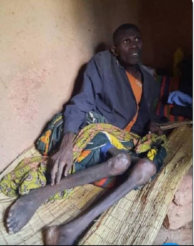 Nyamasheke:Arabarira iminsi ku ntoki ategereje urupfu kubera inzara imwugarije